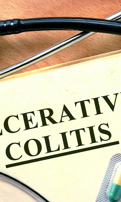 10 Effective Tips for Managing Ulcerative Colitis